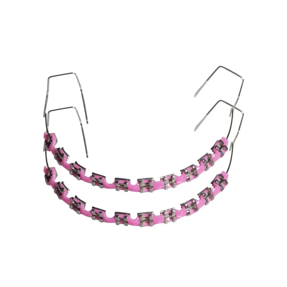 Metal Bracket Fashion Braces, Colorful Temporary Tooth Decoration, High-Quality Orthodontic Ligature Ties