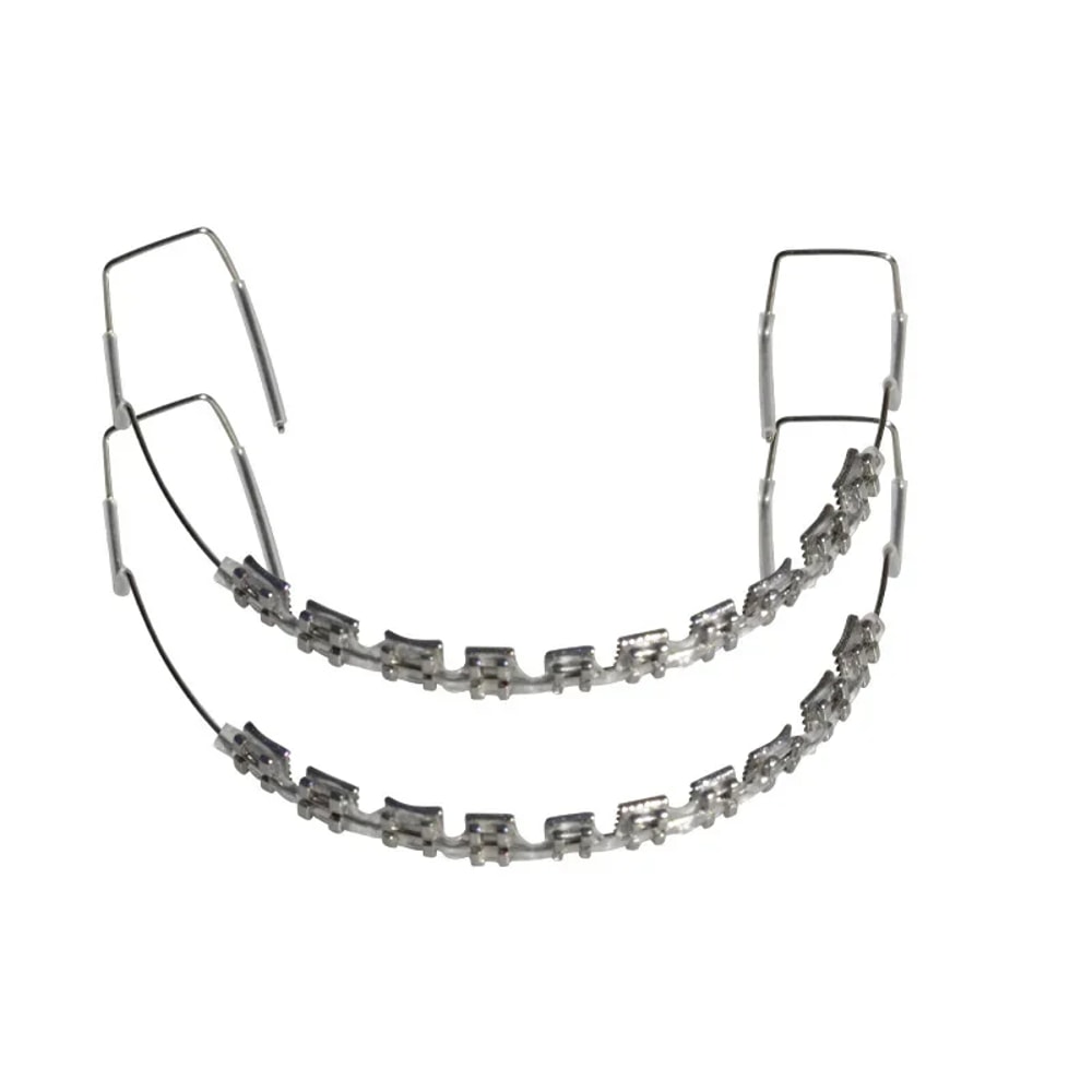 Metal Bracket Fashion Braces, Colorful Temporary Tooth Decoration, High-Quality Orthodontic Ligature Ties