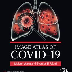 Image Atlas of COVID-19 1st Edition