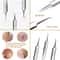 UltraFine No 5 Blackhead Acne Removal Tweezers Professional Beauty Salon Tool 1