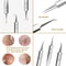 UltraFine No 5 Blackhead Acne Removal Tweezers Professional Beauty Salon Tool 1
