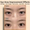 Eye Face Beauty Massager AntiWrinkle Skin Care Device For Facial Lifting Dark Circles Fatigue Re 1