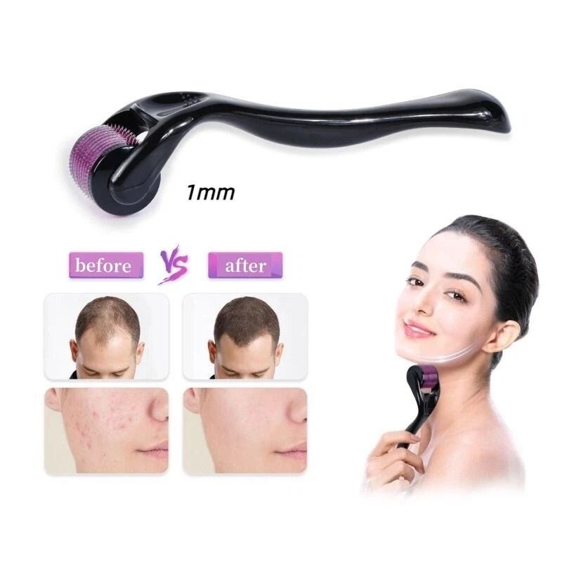540 Titanium Microneedle Derma Roller For Hair Beard Regrowth AntiHair Loss Skin Rejuvenation Col 8