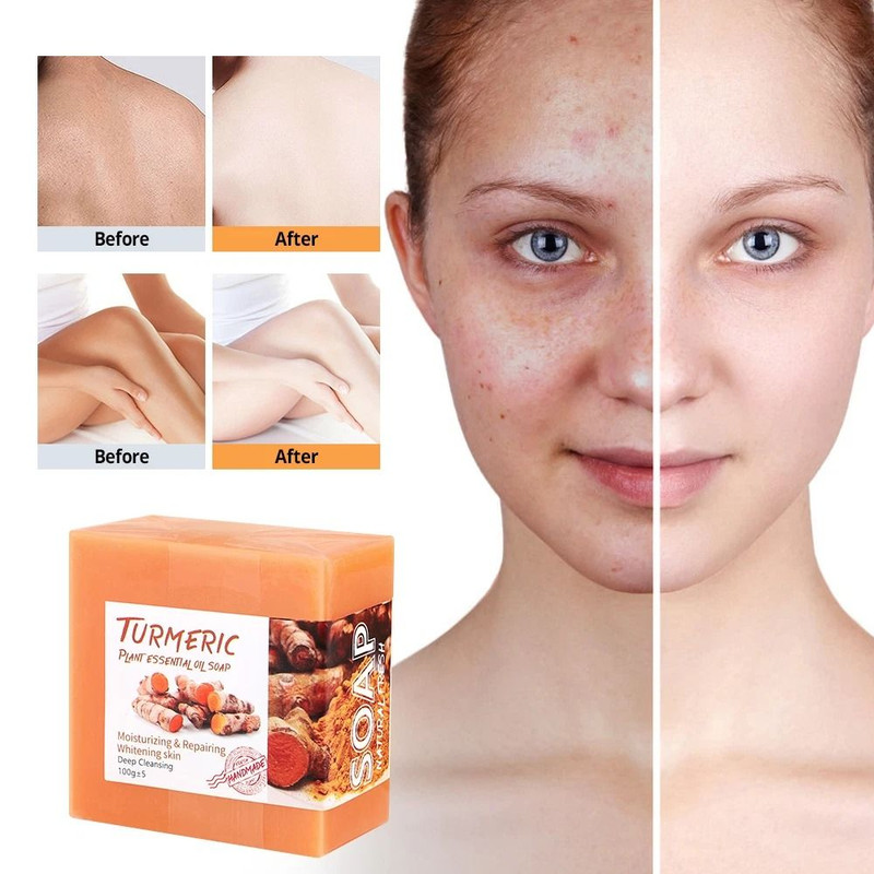 Turmeric Soap Bar For Whitening Brightening Skin Natural Acne Blemish Corrector Dark Spot Remover W 3
