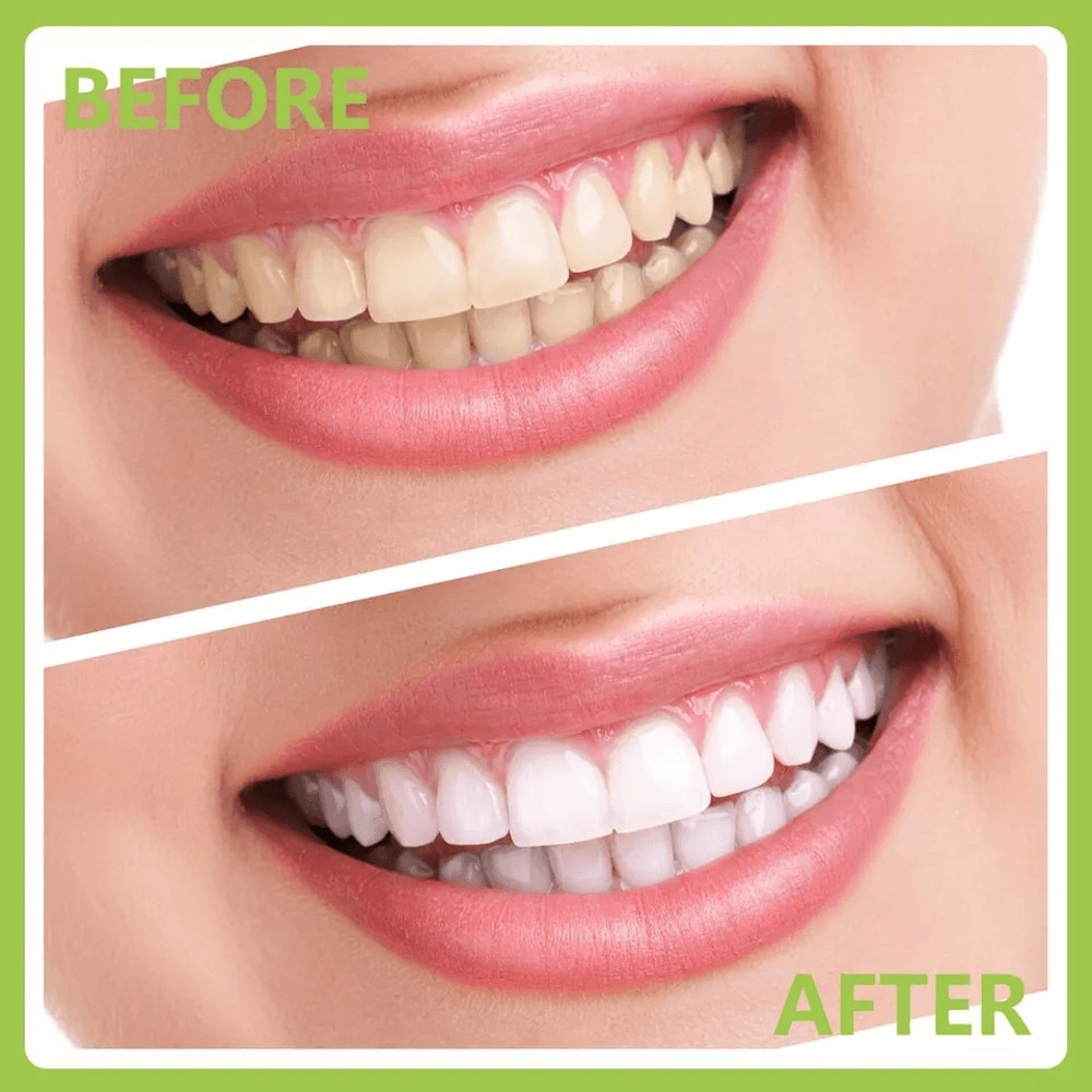 Professional Dental Instruments Tools Scaler Scraper Oral Hygiene Deep Cleaning Set Kit For Teeth C 4