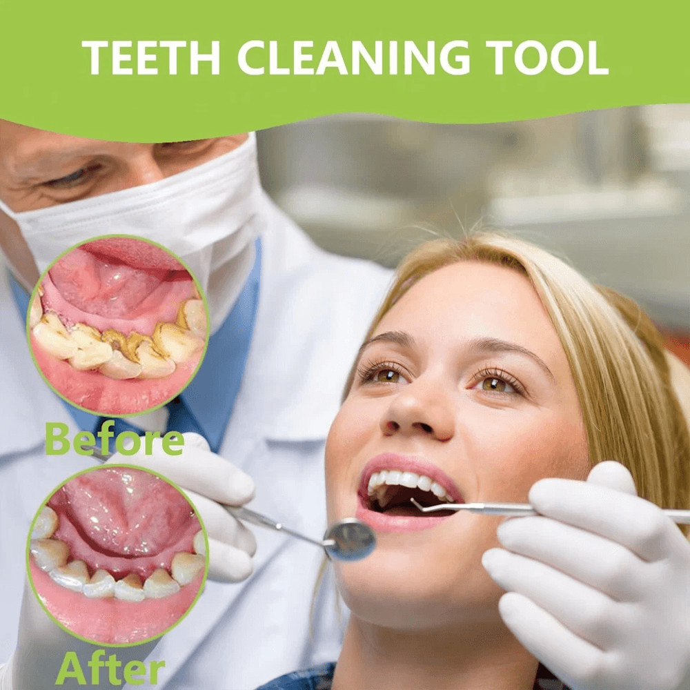 Professional Dental Instruments Tools Scaler Scraper Oral Hygiene Deep Cleaning Set Kit For Teeth C 1