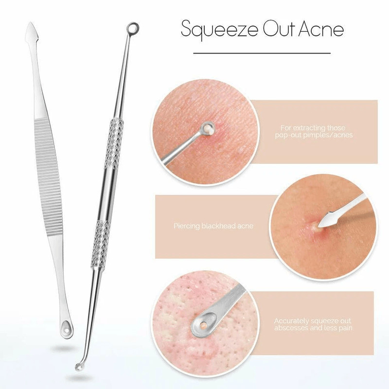 Blackhead Remover Kit Stainless Steel Pimple Popper Tools Comedone Extractor Set For Acne Zit White 6