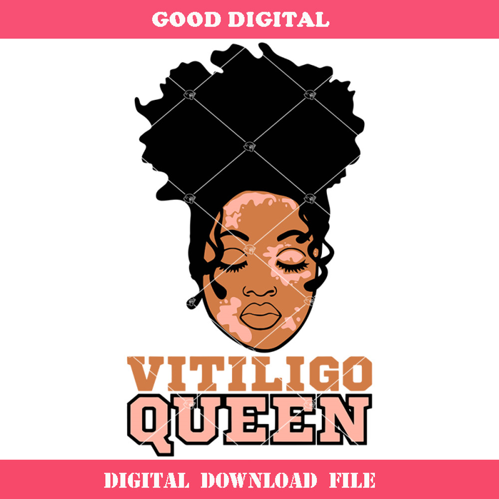 Black Woman In Messy Bun Svg, Vitiligo Queen Svg.jpg