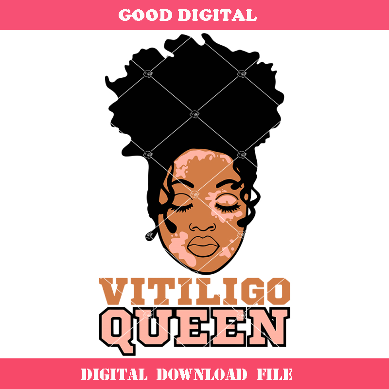 Black Woman In Messy Bun Svg, Vitiligo Queen Svg.jpg