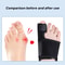 Bunion Corrector, Toe Corrector Orthotics, Bone Thumb Adjuster, Hallux Valgus Corrector, Hammer Protector Tool
