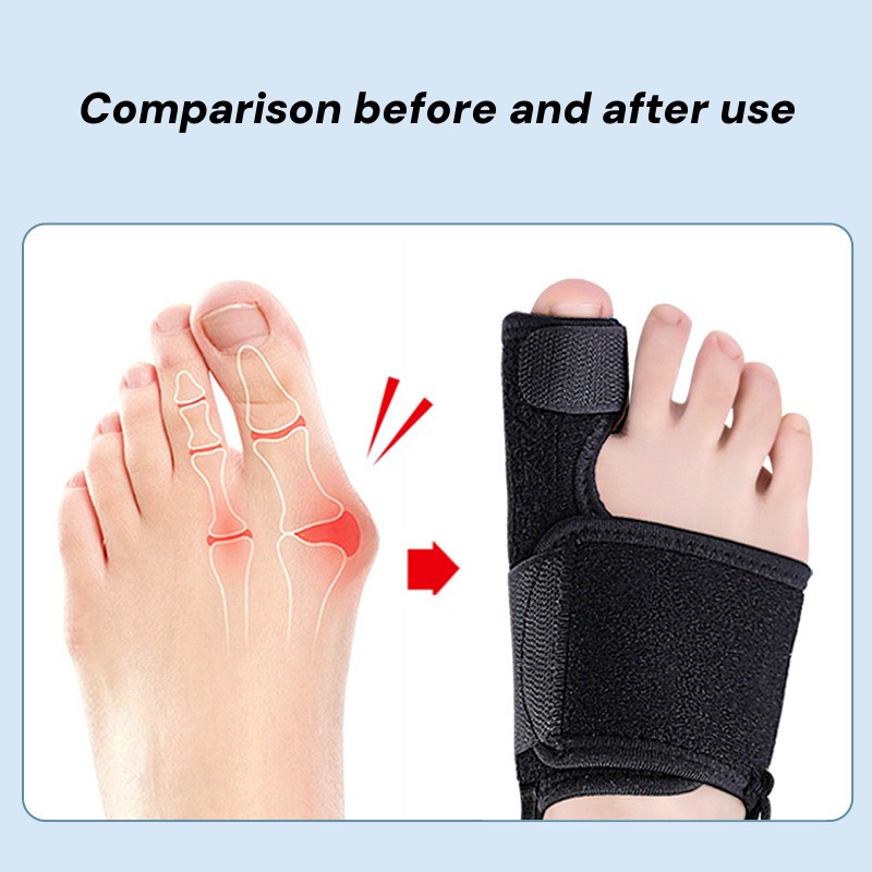 Bunion Corrector, Toe Corrector Orthotics, Bone Thumb Adjuster, Hallux Valgus Corrector, Hammer Protector Tool