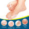 Soft Big Toe Corrector Perfect For Night And Home Use Longterm Relief From Bunions 3