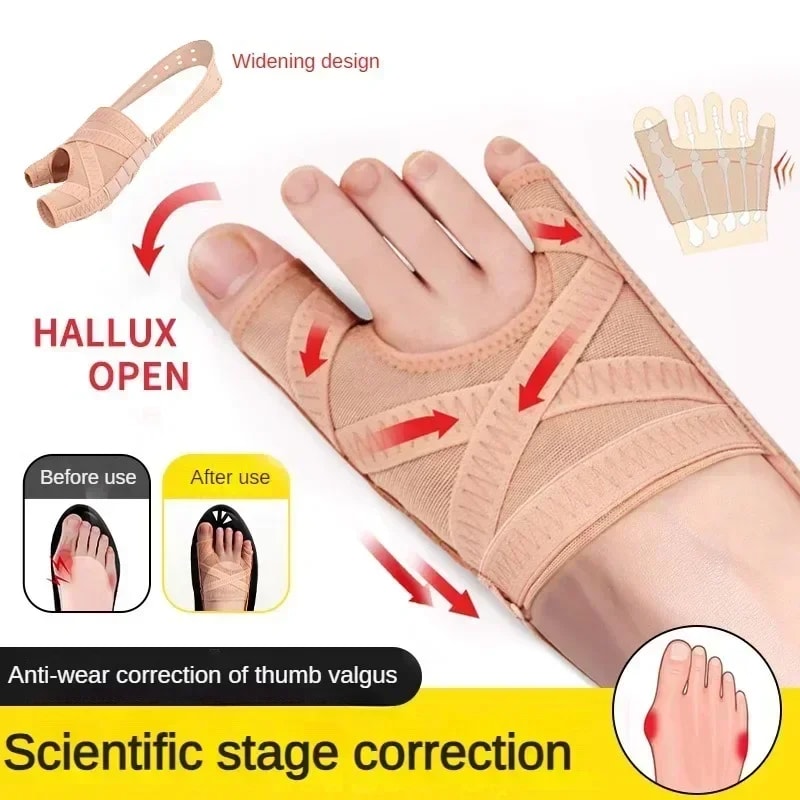 Breathable Fabric Bunion Corrector Toe Separator Spacer Hallux Valgus Sleeve Comfortable Adjustable 1