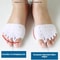 Toe Separator for Women, Hallux Valgus Corrector, Bunion Corrector, Toes Spreader, Hallux Separator, Fingers Separators