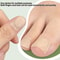 Nail Art Foot Patches Feet Care Ingrown Toenail Toe Correction Stickers Paronychia Treatment Recove 1