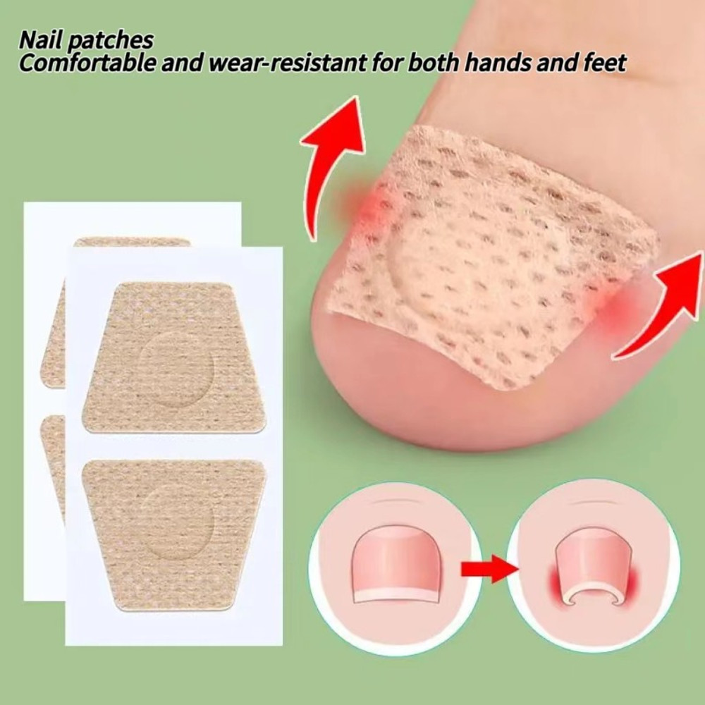 Nail Art Foot Patches Feet Care Ingrown Toenail Toe Correction Stickers Paronychia Treatment Recove 2
