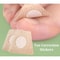 Nail Art Foot Patches Feet Care Ingrown Toenail Toe Correction Stickers Paronychia Treatment Recove 3