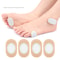 Foot Care Sticker Corn Removal Pads Medical Patch Calluses Remove Curative Patches Summer Foot Care 0
