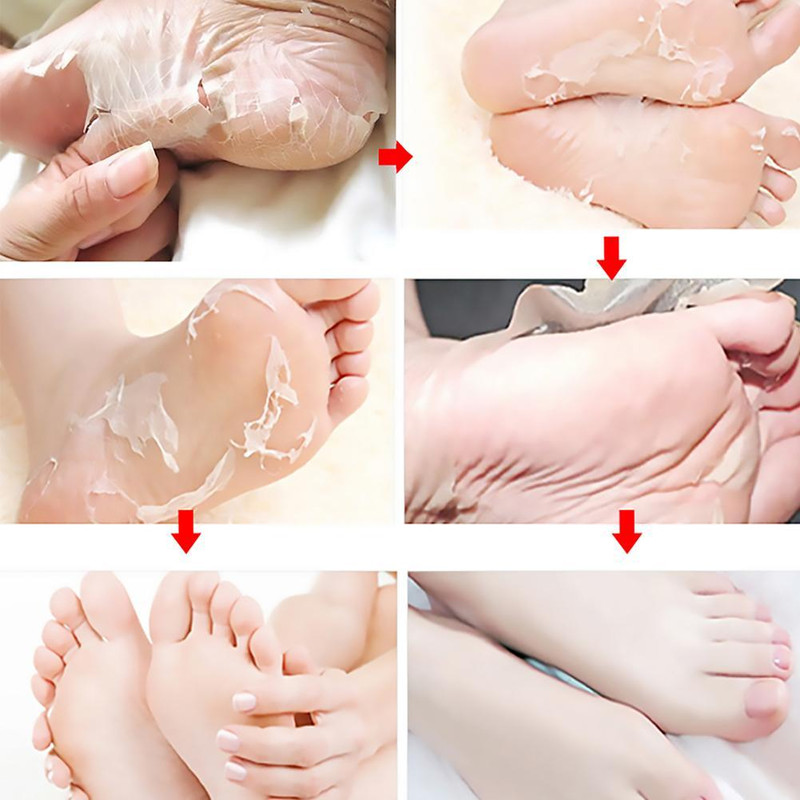 Moisturizing Foot Exfoliating Mask, Exfoliating Foot Care Tool, Dead Skin Remover, Smooth Soft Feet