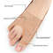 Title Option 2: Lightweight Breathable Toe Separator, Mesh Thumb Valgus Corrector, Bigfoot Bone Overlapping Corrector