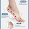 Lightweight Ankle Brace Toe Separation, Adjustable Toe Thumb Valgus Corrector, Comfortable Bigfoot Bone Correction