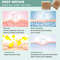 Medical Grade Silicone Scar Sheet Painless Effective Scar Repair Tape Silicone Scar Tape For Surgic 1