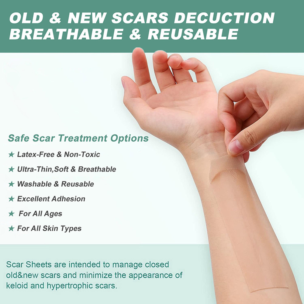 Medical Grade Silicone Scar Sheet Painless Effective Scar Repair Tape Silicone Scar Tape For Surgic 2