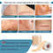 Medical Grade Silicone Scar Sheet Painless Effective Scar Repair Tape Silicone Scar Tape For Surgic 5