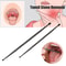 Stainless Steel Tonsil Stone Removal, 1pcs Ear Wax Remover, Mouth Cleaning Care Tools, Health Care