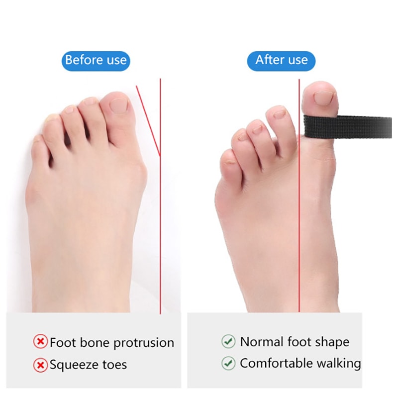 Hallux Valgus Toe Straightener Foot Stretch Recovery Training Exerciser Strap Thumb Elastic Band Fo 4