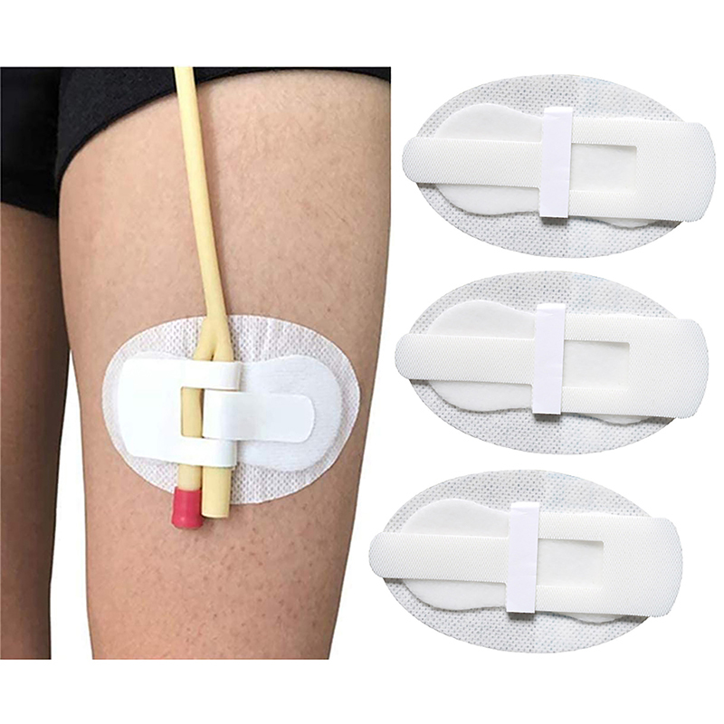 Urinary Clip Securement Legband Catheter Holder Tube Sticker Fixation Drainage Anchor Stabilizer Ta 1