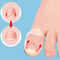 Invisible Ingrown Toe Nail Straightening, Silicone Toenail Correction Tool, Durable Reusable Protector for Foot Care