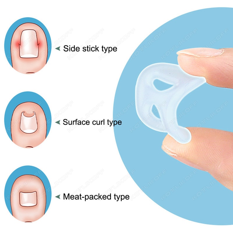 Invisible Ingrown Toe Nail Straightening, Silicone Toenail Correction Tool, Durable Reusable Protector for Foot Care