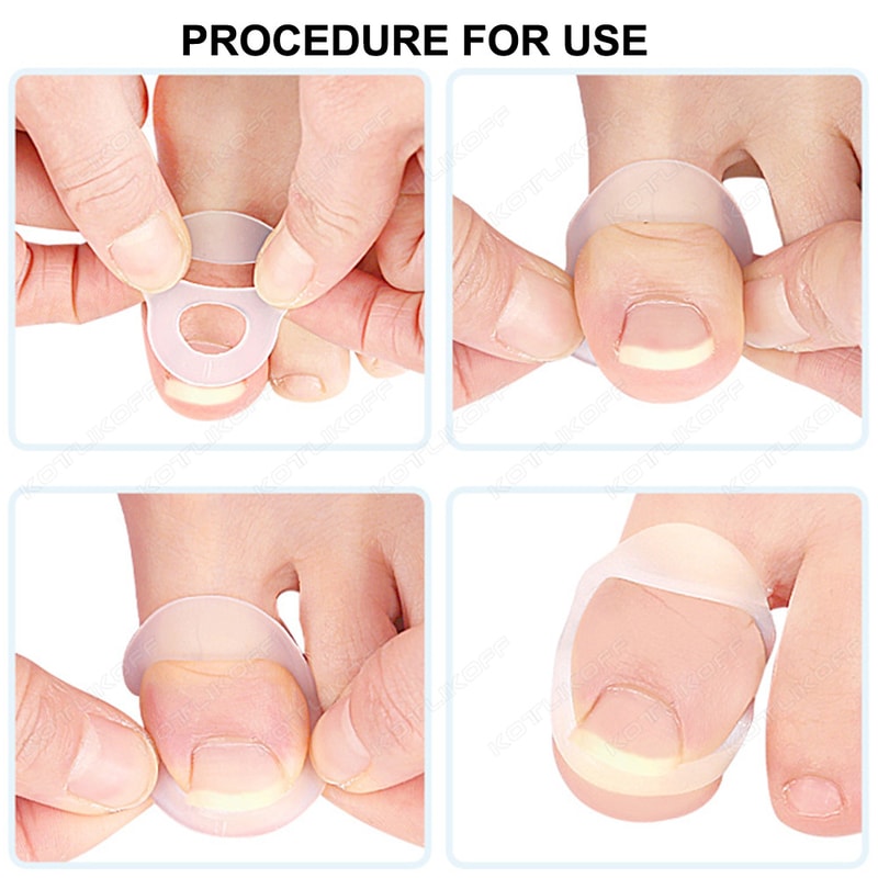Invisible Ingrown Toe Nail Straightening, Silicone Toenail Correction Tool, Durable Reusable Protector for Foot Care
