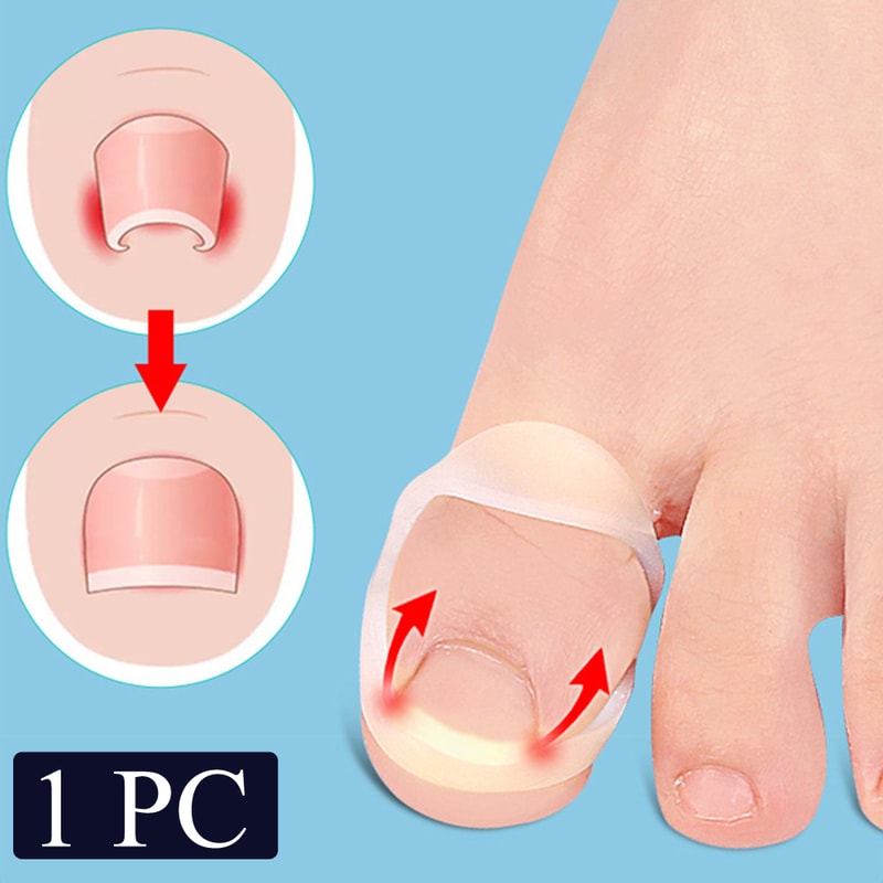 Invisible Ingrown Toe Nail Straightening, Silicone Toenail Correction Tool, Durable Reusable Protector for Foot Care