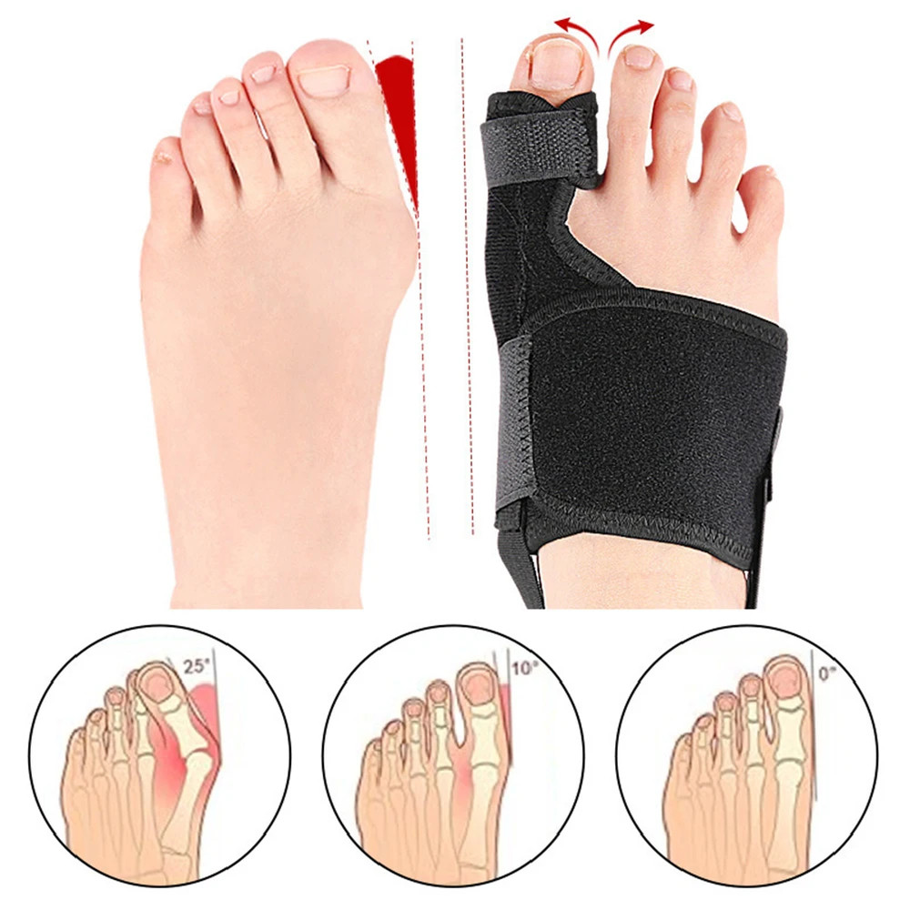 Hammer Protector Hallux Valgus Corrector, Toe Corrector Orthotics Bone Thumb Adjuster, Bunion Corrector Orthopedic Tool