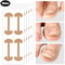 Lasting Adhesion Waterproof Nail Correction Strips, Professional Toe Care Pedicure Tools, Stickers Elasticity