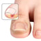 Lasting Adhesion Waterproof Nail Correction Strips, Professional Toe Care Pedicure Tools, Stickers Elasticity