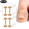 Lasting Adhesion Waterproof Nail Correction Strips, Professional Toe Care Pedicure Tools, Stickers Elasticity