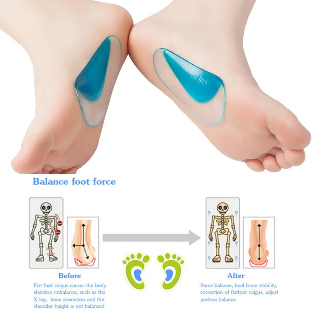Flat Foot Corrector Insole, Silicone Gel Arch Support, Professional Orthotic Shoe Cushion for Foot Alignment
