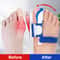 Orthopedic Braces Toe Correction Bunion Device Hallux Valgus Night Foot Care Corrector Thumb Daily 1