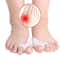 Toe Separator Hallux Valgus Buffer, Silicone Toe Corrector, Improve Foot Health and Comfort Instantly