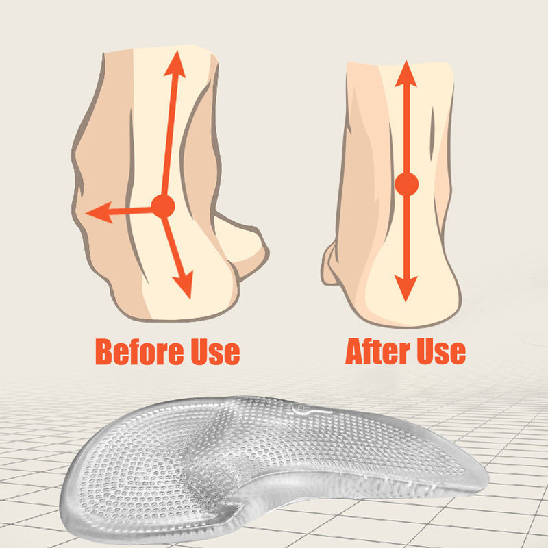 Arch Support Foot Insoles for Plantar Faciitis Pain Relief Shoe Pads, Silicone Gel Orthopedic Insoles for Shoes Women