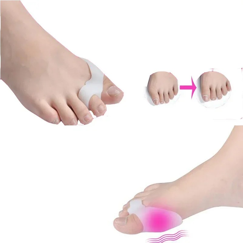 Silicone Gel Two Hole Toe Separator Thumb Valgus Protector Hallux Valgus Guard Bunion Adjuster For 3