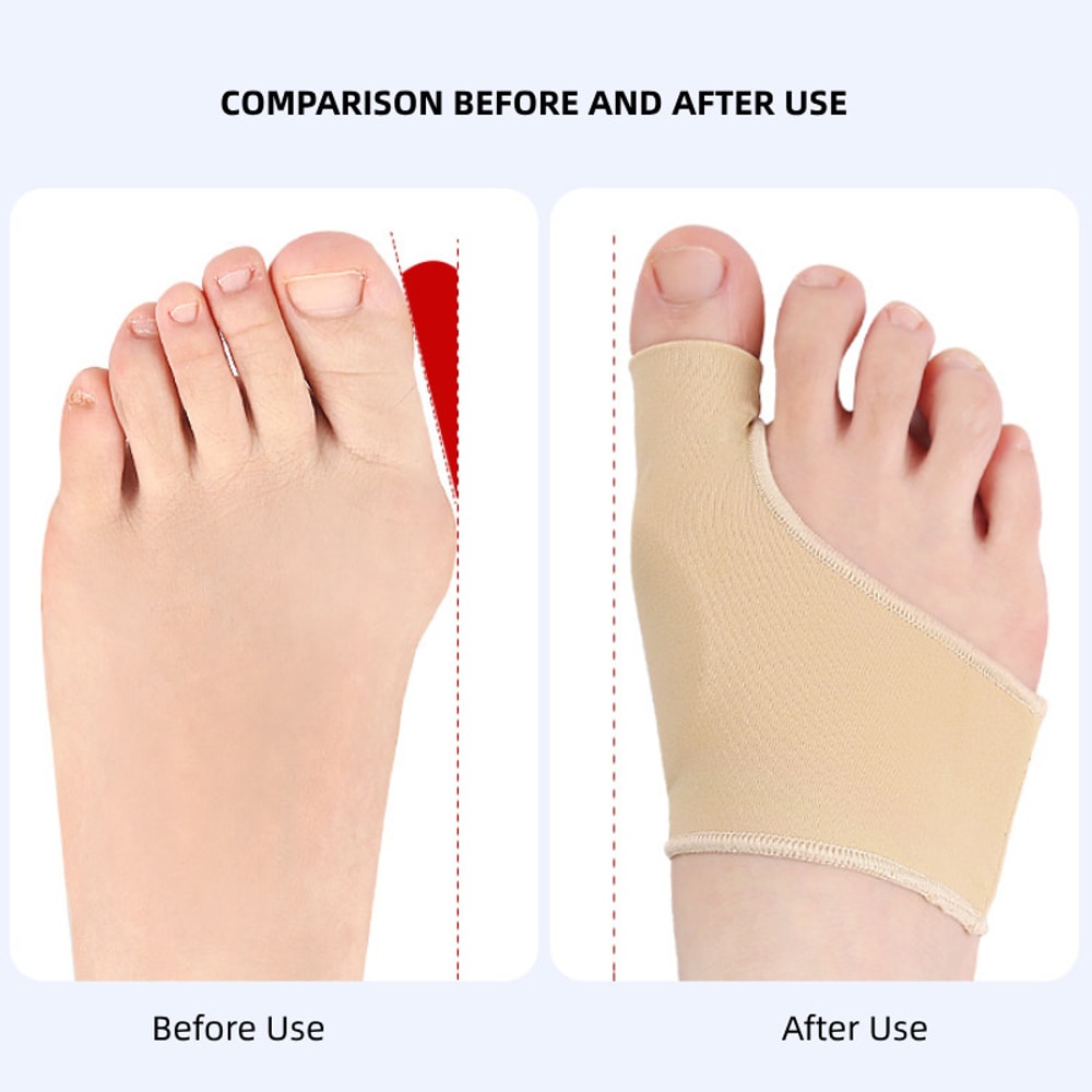 Hammer Toe Straightener, Foot Pain Relief, Toe Separator, Hallux Valgus Bunion Corrector