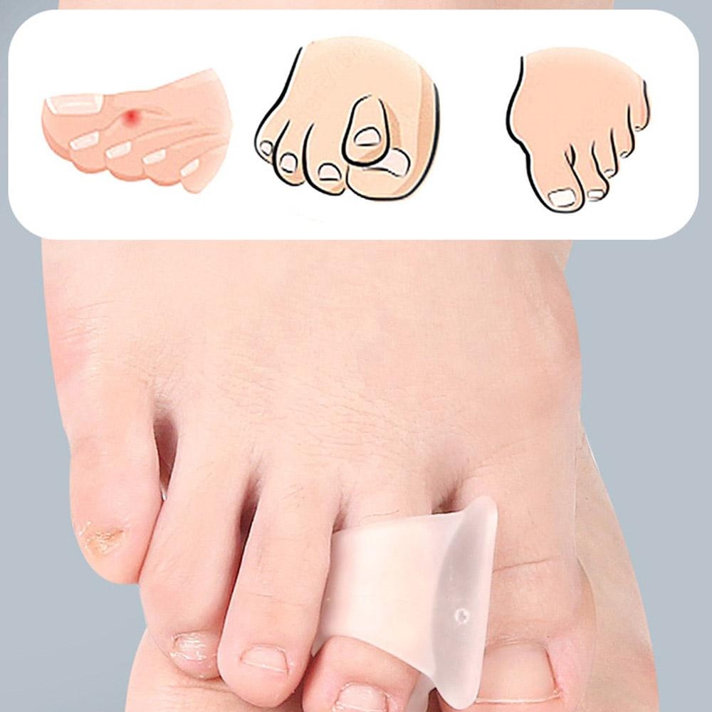 Hammertoe Corrector for Curled Crooked Bent and Claw Toe, Toe Orthotics Straighteners for Men and Women, Anti Fungi Feet