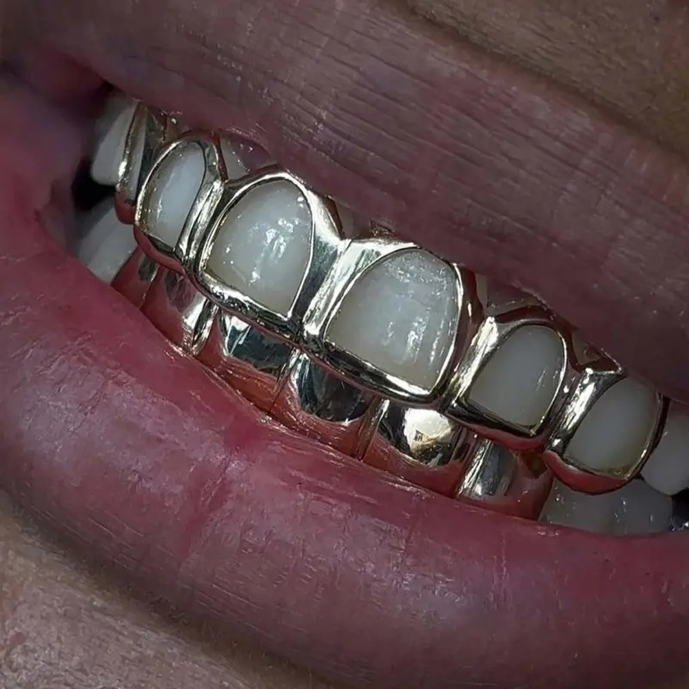 Hip Hop Teeth Grillz Set Stylish Six Tooth Lower Teeth Ornaments for Stage, Festival & Party