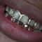 Hip Hop Teeth Grillz Set Stylish Six Tooth Lower Teeth Ornaments for Stage, Festival & Party
