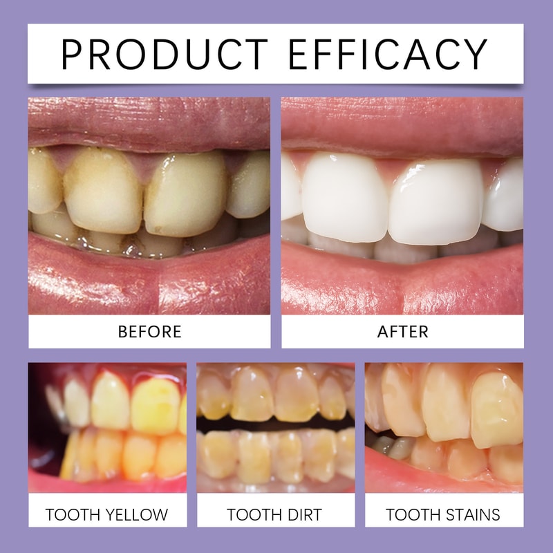Premium Purple Teeth Whitening Strips Gentle Stain Removal Oral Care Strips For Sensitive Teeth 5