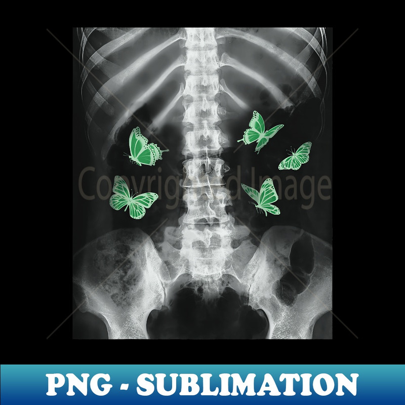 Egirl Xray Skeleton Green Butterfly Harajuku Dark Grunge Alt - PNG Sublimation Digital Download